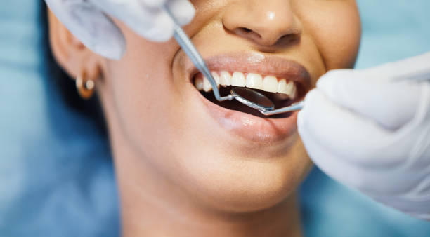 Best Lost Filling or Crown Replacement in Apollo Beach, FL